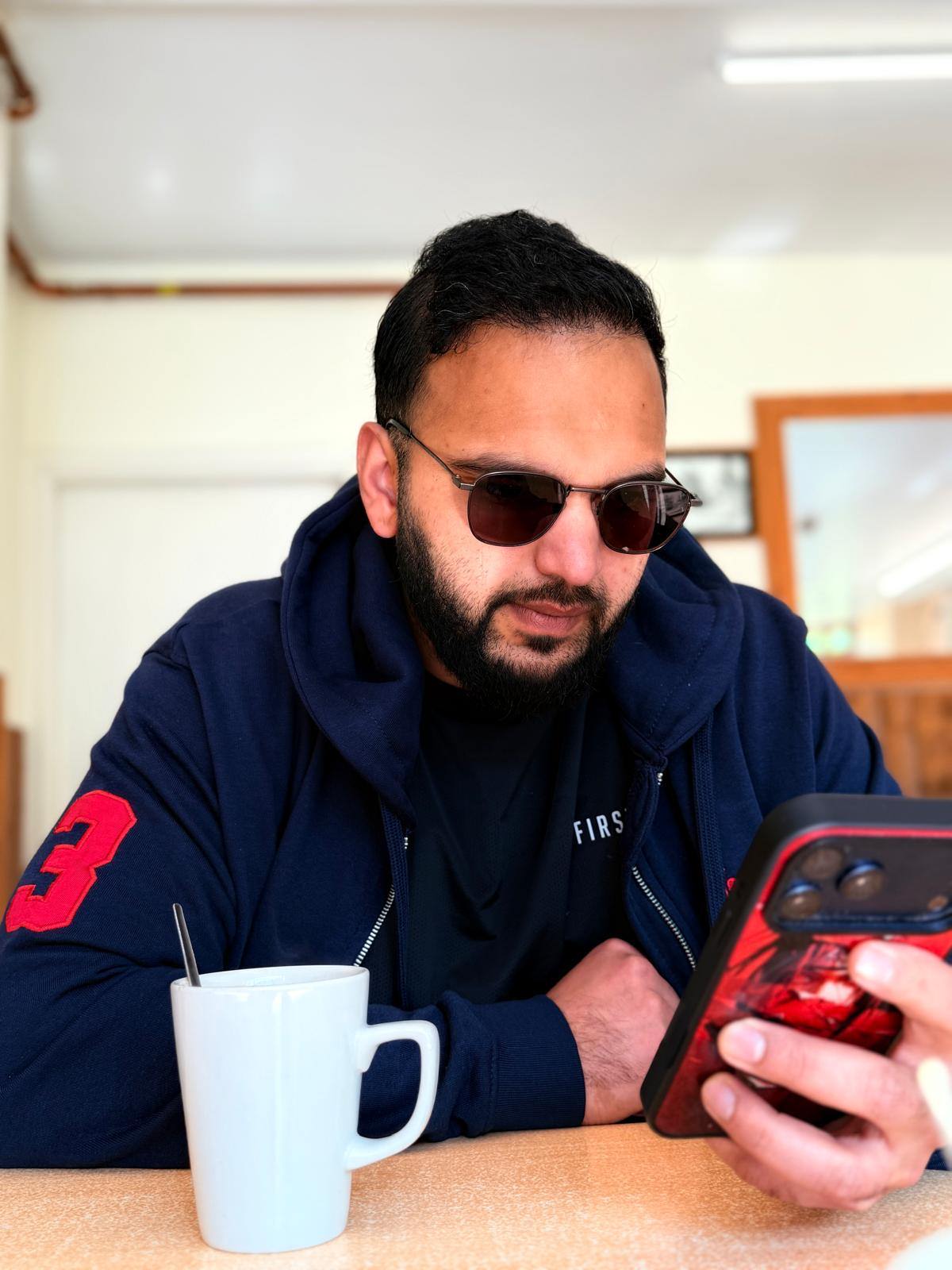 Norwood 7 hair transplant — Hussain result photo 7